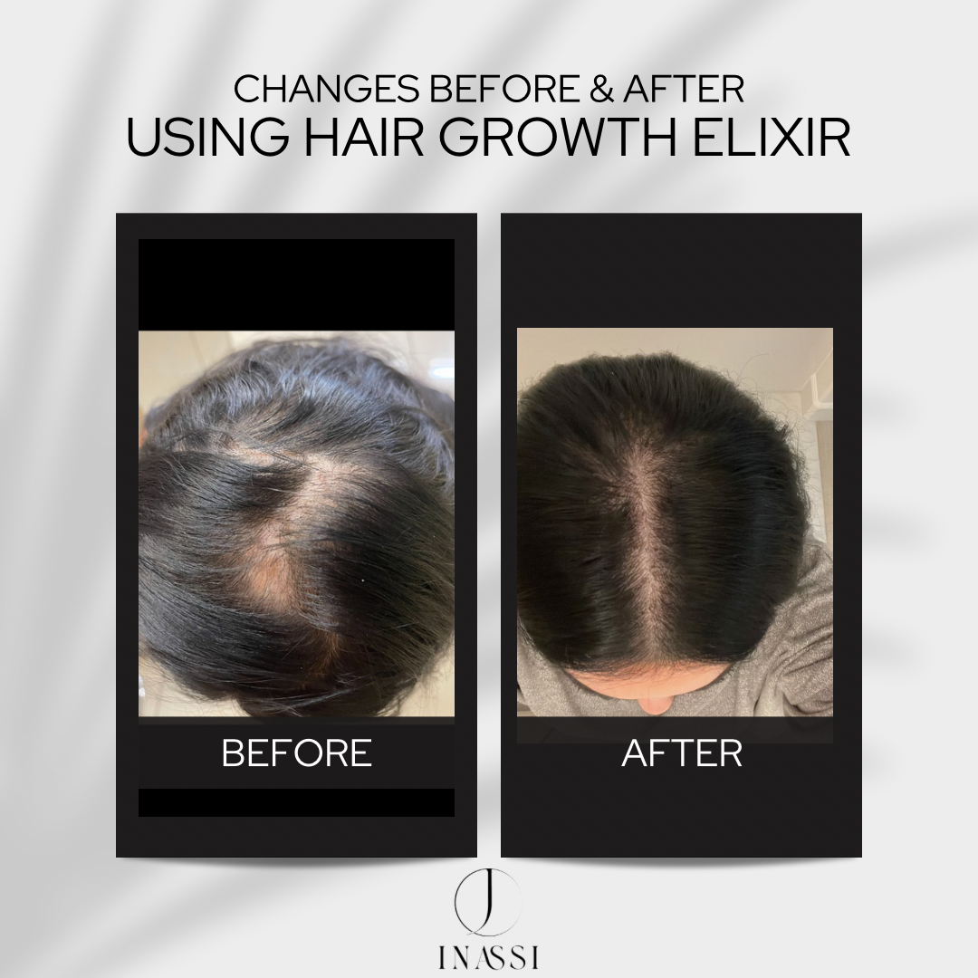 Hair Growth Elixir